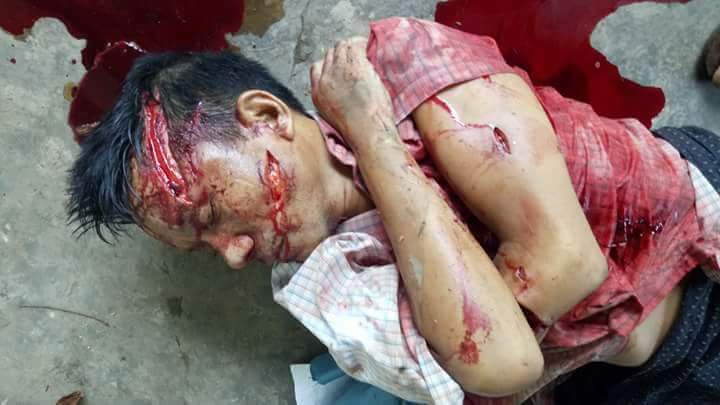 eithetthetaung2's tweet photo. @AJEnglish Are you seen?Bengali Terrorists kill them. https://t.co/uVKclnvjrp
