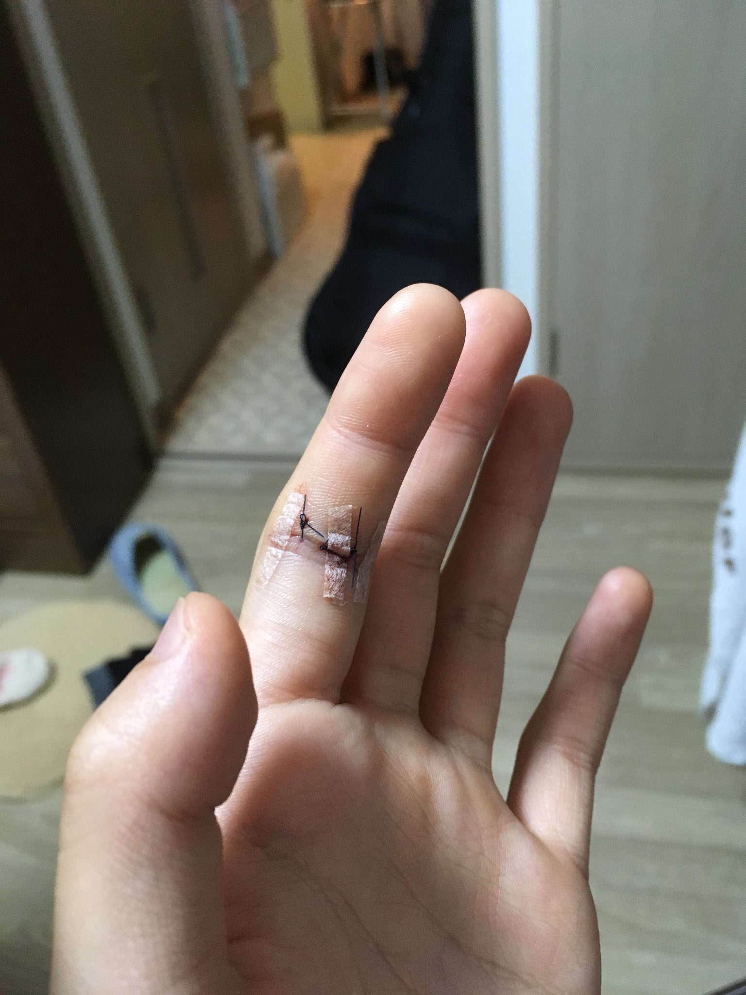 ミント บนทว ตเตอร グロ注意 じつは今日包丁で指を切ってしまいました 病院行って指縫ってもらって 今は痛みも腫れも引いてて あとは治るのみって感じですw 指先を見ると なんかフランケンシュタイン的なw リアルハロウィン的な感じだなって思い