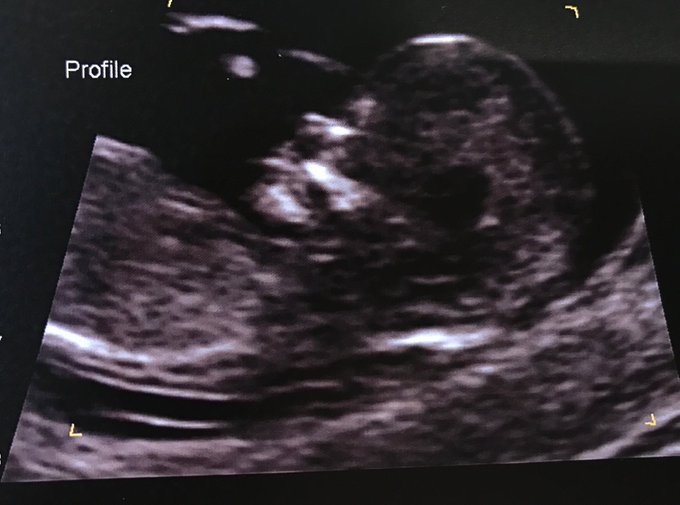 View image on Twitter