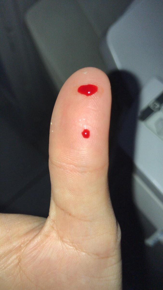 sincelliars's tweet photo. Vocês já grampearam o dedo ? https://t.co/gT4R98XLvL