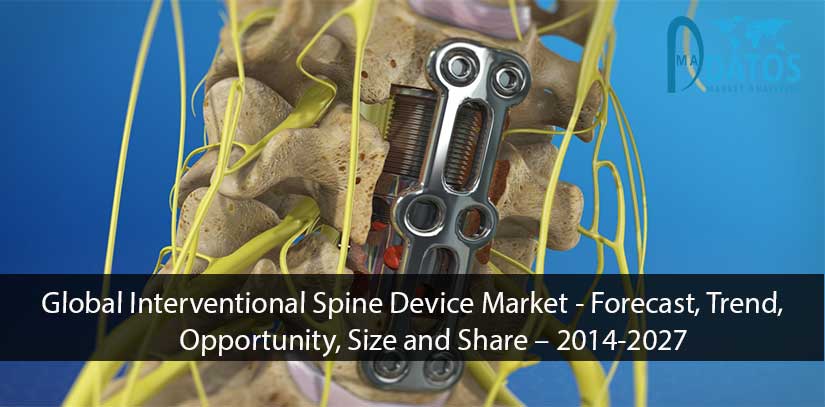 Datos_Market's tweet photo. Global Interventional Spine Device Market 

https://t.co/ZtzTMxnh6O https://t.co/ySy8LTcRWJ