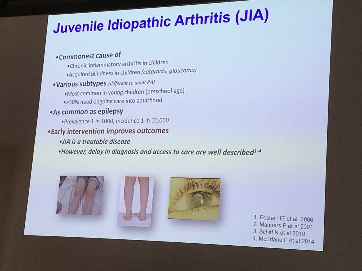 1 in 1,000 children have some form of #arthritis - Helen Foster at Global Alliance for MSK Health meeting #GMUSC2017 #PaediatricRheumatology