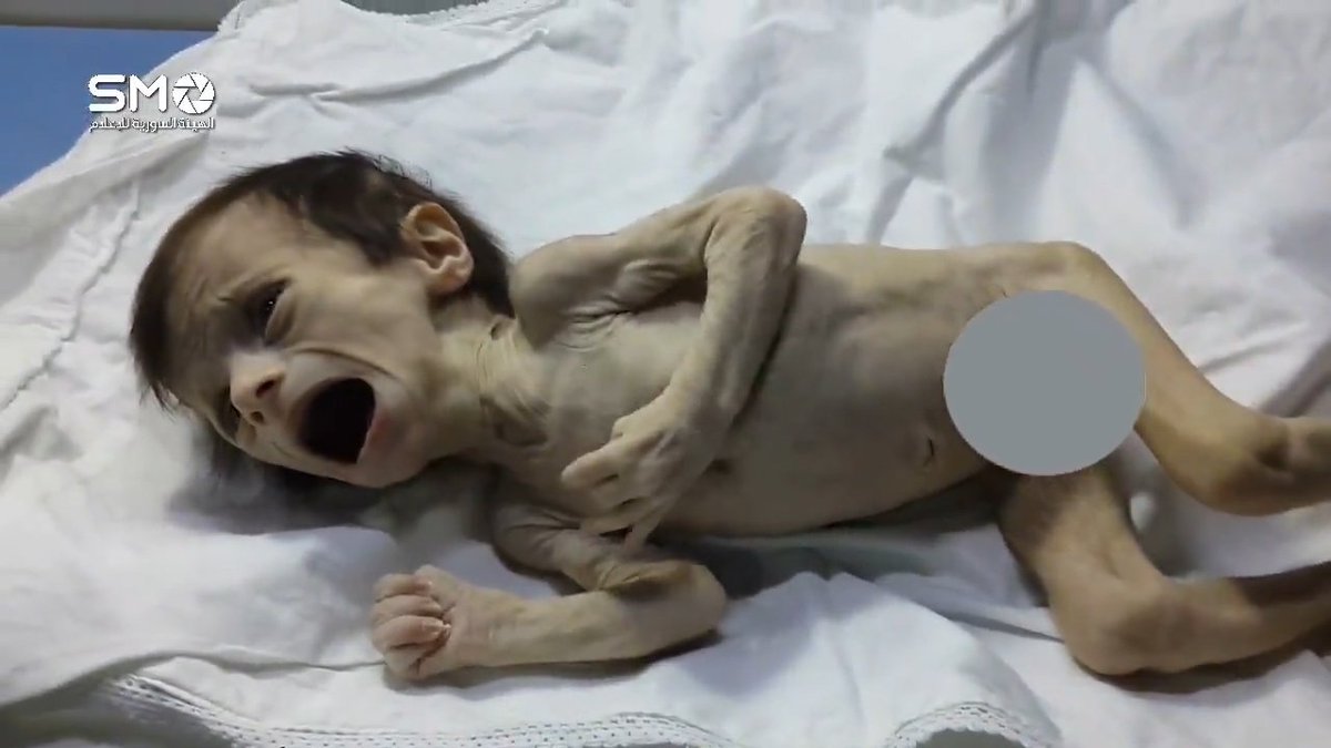 SyriaCharity's tweet photo. 8h de tentatives pr la sauver,elle a perdu la vie. 34 jr de vie ont suffit pr l'épuiser,entre guerre &amp; famine, pires fardeaux de l'#Humanité https://t.co/6PUkNLvibA