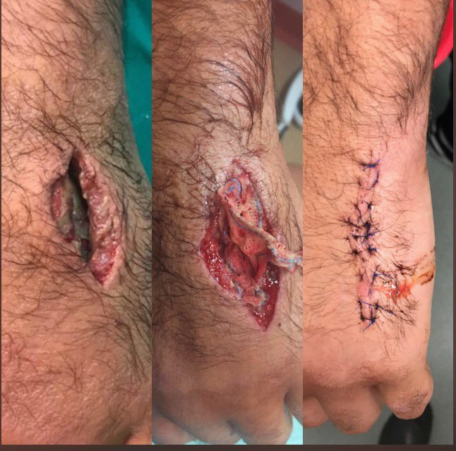 scottbaldwin2's tweet photo. 3 games missed, 4 ops later &amp; not the result we wanted yesterday but good to be back out with the boys #Live&amp;learn #LuckyEscape https://t.co/ZWz9vDg2L0