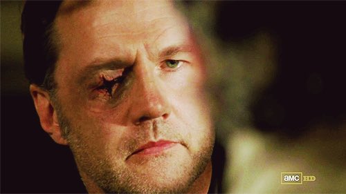 #RuinADateIn4Words. Wanna see my eye?