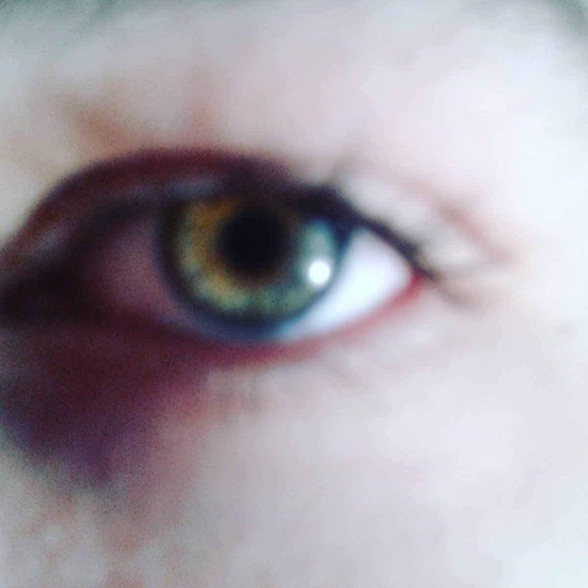 LexisMiller7's tweet photo. Mine or my brother's eye? (my brother's is the first pic) https://t.co/rCMwcgySew