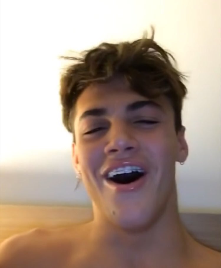 ploytion's tweet image. hes such a cute foking bean w his retainers uGH