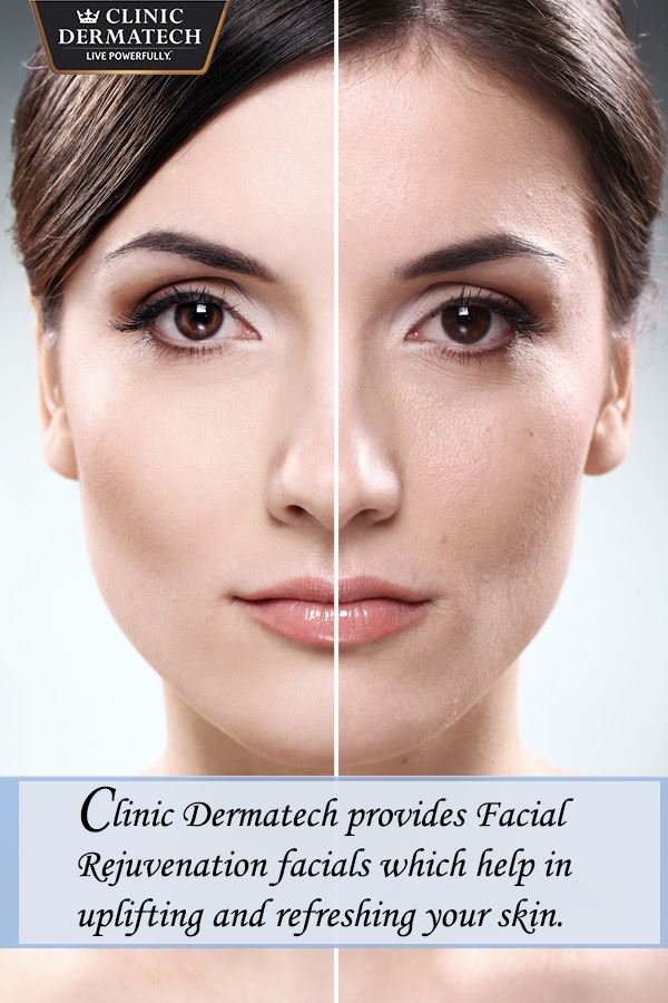 clinic_dermatec's tweet photo. #Clinic #Dermatech provides Facial Rejuvenation facials which help in uplifting and refreshing your skin. #FacialRejuvenation #Beauty https://t.co/t4gWQiTHZg
