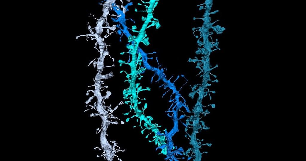 gethapi_co's tweet photo. Starting Your Day on the Internet Is Damaging Your Brain https://t.co/Mp39YclNlA https://t.co/5L6Pv5yUxw