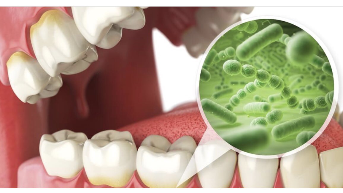I cibi nemici dei denti a cui non hai mai pensato, quali sono?
Scoprilo leggendo l'articolo sul nostro blog!

#COS
cioesse.it/cibi-nemici-de…