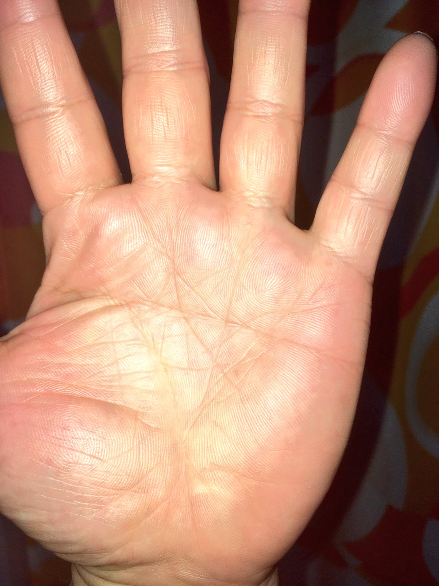 太陽線とは 意味や見方 太陽線の特徴でわかる手相占い25選を紹介 セレスティア358