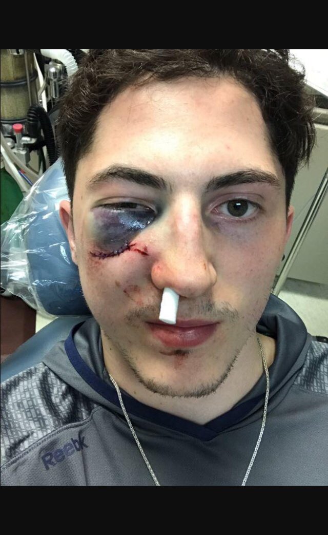 ian_herrmann's tweet photo. I feel your pain @ZachWerenski @BlueJacketsNHL https://t.co/gll4eOQqC7