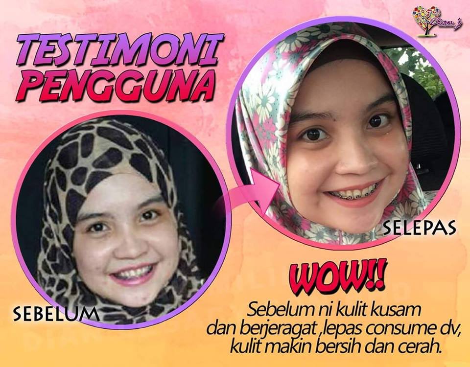 dianz_vit's tweet photo. yang nak hilangkan jerawat, jeragat, parut lama, exzema, putihkan kulit boleh guna #dianz vit. mmg tak rugi.
📱 : https://t.co/SMccyn3LaP https://t.co/FcURpQfSQ3