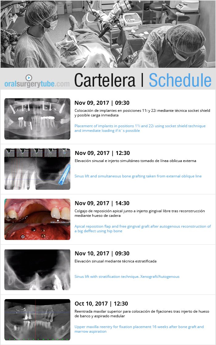 oralsurgerytube's tweet photo. #socketShield #elevaciónSinusal #injertoGingival #huesoCadera #huesoBanco #aspiradoMedular esta semana en directo en https://t.co/y4pCN7GGTx https://t.co/8yOemH8VaS