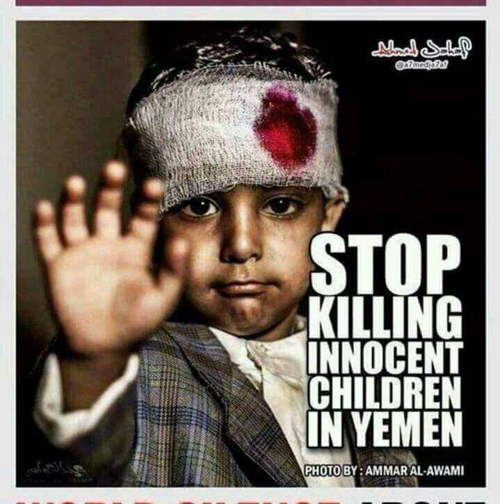 Moon_Kidnapper's tweet photo. @LennyReddy @LilySej1 @Rasa171a @VitalAnon @BearmanShannon @njmth_alsalh @maximors63 @RiseUp75 @SenAlexander @SenJohnBarrasso @RoyBlunt @JohnBoozman @SenatorBurr @SenCapito @BillCassidy @SenThadCochran @SenatorCollins @SenBobCorker @SenTomCotton @RepAdamSmith @tedlieu @SenJackReed @SenJeffMerkley @SenatorCardin @SteveDaines @SenatorEnzi @SenJoniErnst @LindseyGrahamSC @SenCoryGardner @JeffFlake @SenatorFischer @senorrinhatch @SenJohnHoeven @JimInhofe @RepAdamSchiff @JimmyGomezCA @SteveKnight25 @UN @UNHumanRights @UNReliefChief @KenRoth @DavidShuster @MimiWaltersCA @DanaRohrabacher @NancyPelosi @A_ofAnon @DashTheHabbery @OpPedoHunter_ @scottMontgomery @FedericaMog In #Yemen killed humanity, childhood,women &amp; absent Justice &amp; became a human senseless.
Still kills by support of US 2 Saudi,vote #HConRes81 https://t.co/yciszRQMCa