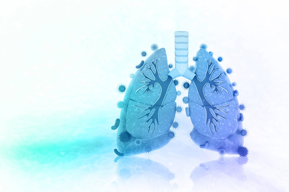 The Lung Microbiome and ARDS: It’s Time to Broaden the Model atsjournals.org/doi/abs/10.116…