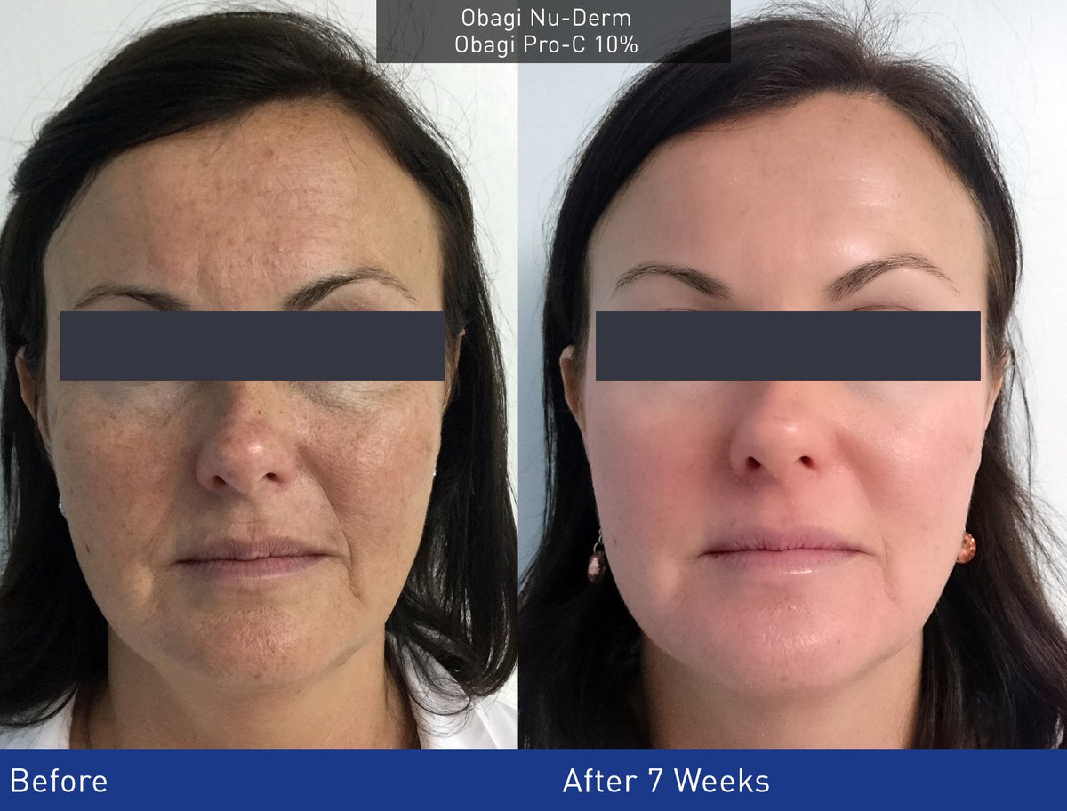 HealthxchangeUK's tweet photo. We are delighted to announce the winner of the #ObagiChallenge.  Congratulations Dr Aarti Denning from Reverse Time! https://t.co/K7TxhfBfU8