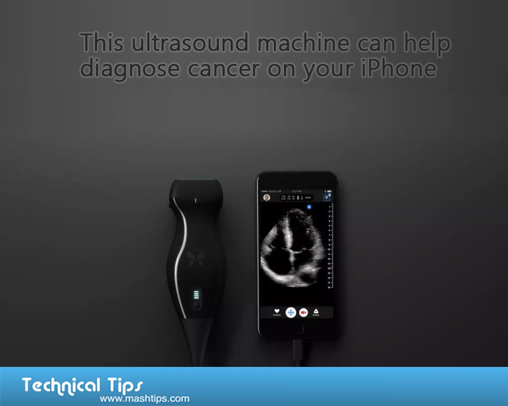 mashtips's tweet photo. The Butterfly iQ is One of the first-ever portable ultrasound machines in the world.
#iPhoneX #MashTips #FirstEver https://t.co/qTiMEvBN1s