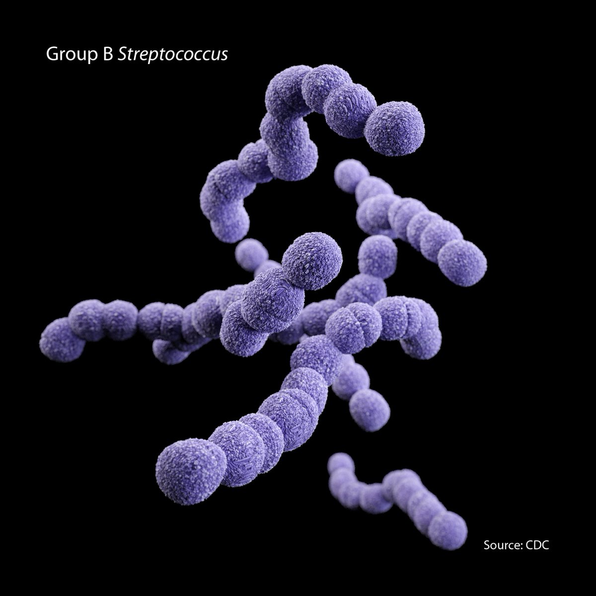 imperialcollege's tweet photo. Group B Strep infection may cause 150,000 stillbirths and infant deaths a year, study shows https://t.co/IdC3dj3PvC #GBSburden #StepB https://t.co/lcS2HWilj2