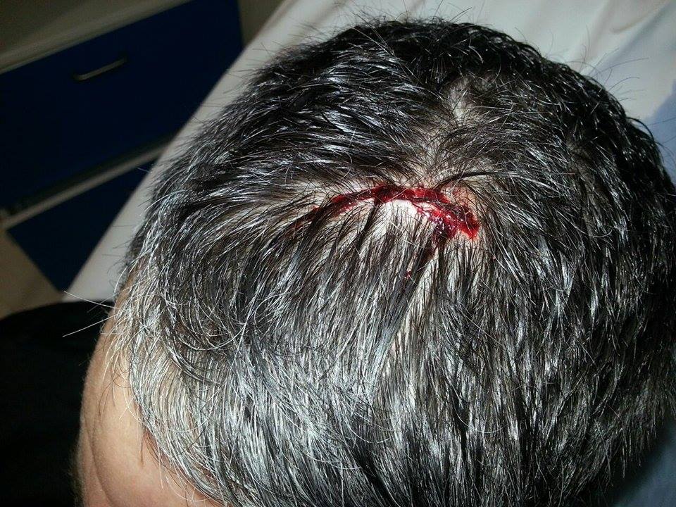 EssexPoliceFed's tweet image. Chairman talks of wide need to #ProtectTheProtectors essexfedfocus.co.uk/?p=3822