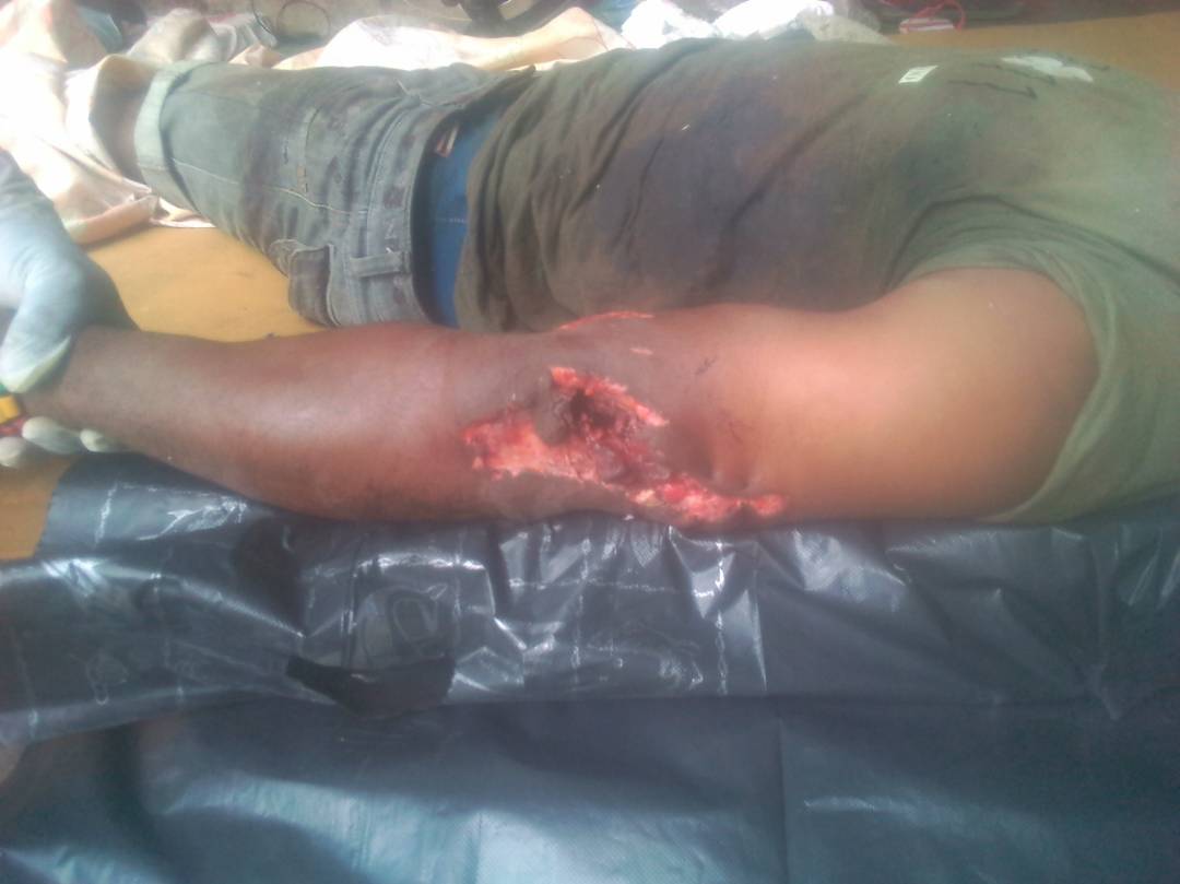 floxydiada's tweet photo. Peaceful protesters shot by the military of #LaRepubliqueDuCameroun bc there exist no freedom of speech in #Cameroun 
#SouthernCameroons https://t.co/NmqiuxYWfH