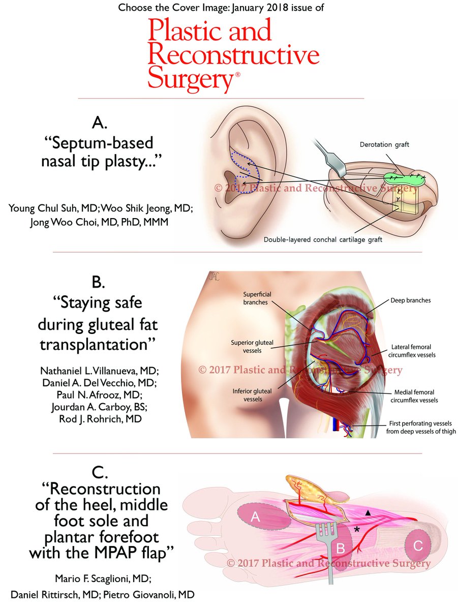 prsjournal's tweet photo. Vote in the Poll below to help us choose the January 2018 COVER IMAGE of #PRSJournal! #Plasticsurgery https://t.co/nIIEt1bxMZ