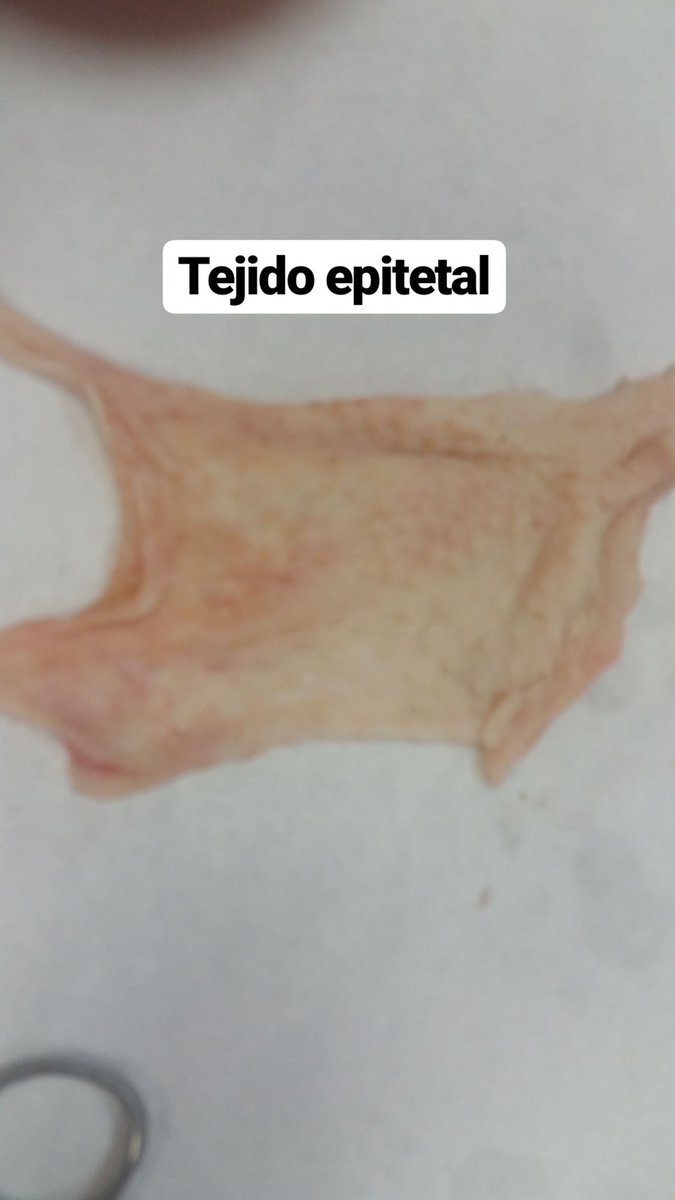 DanielLorenzo30's tweet photo. Identificando tejidos #3BIO #Threes #MdrSanGabiel https://t.co/ZoKHGrveGV