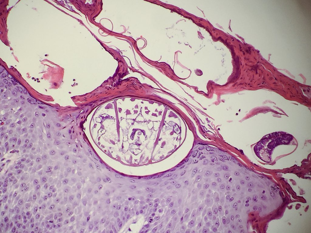 I swear they were looking at me... 😳 #Scabies