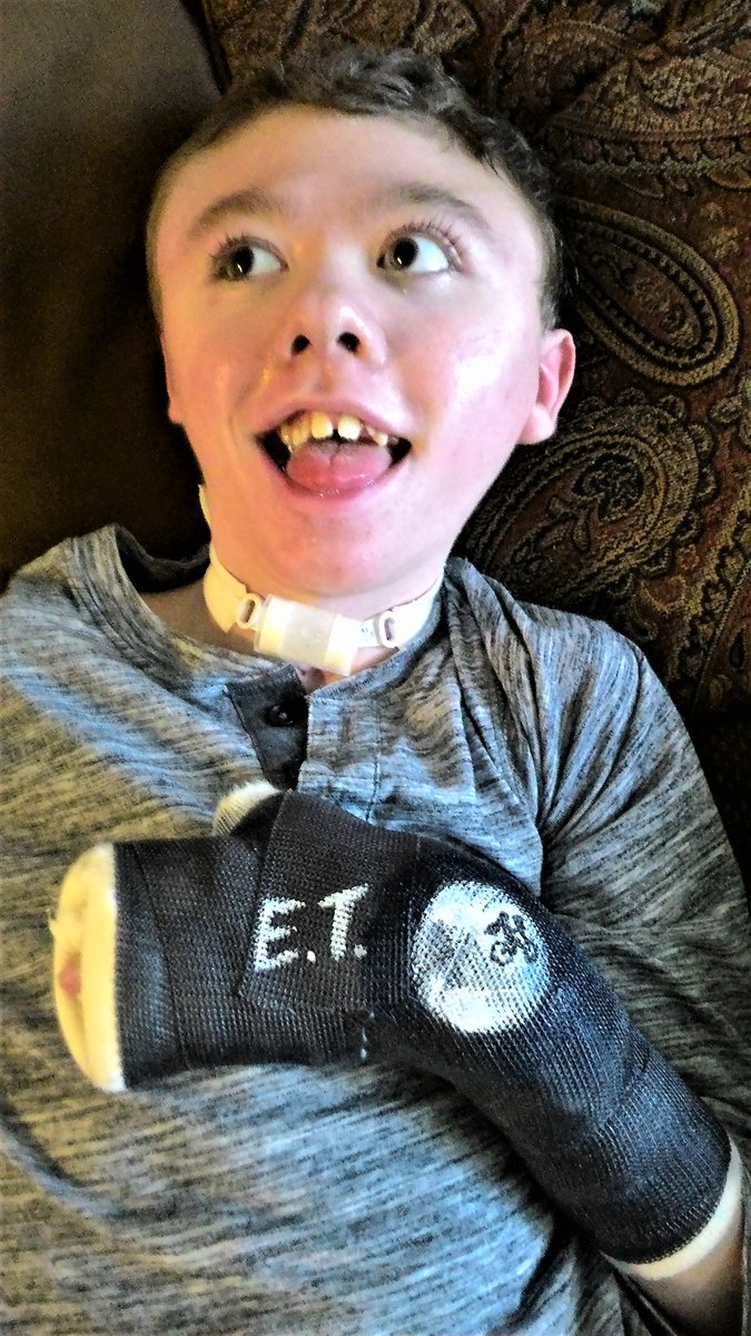 BryanHosey's tweet photo. Mason says thank you mommy @BrittanyHosey for my cast art and can I show off a little to some cool kids? @johncampea @ColliderVideo https://t.co/x1tdqmhuX3