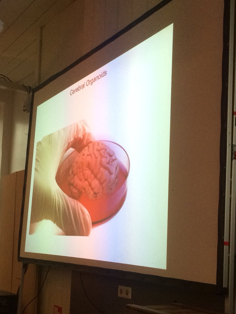 dondersdiscuss's tweet photo. Expectation/reality in the "brain in a dish" idea. @naelnadif goes real! #dd2017 @DondersInst https://t.co/gbjl9ijOKk