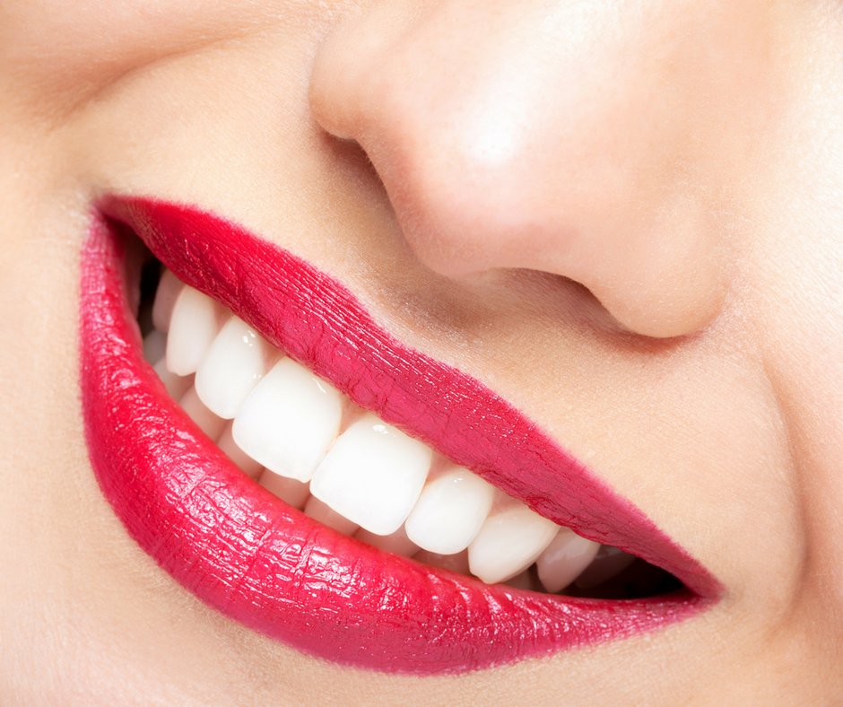 HB_Express's tweet photo. Your smile is 1 of the very first things people notice about you!✨We currently have 15% OFF this teeth whitening kit❕https://t.co/ceywyquKz5 https://t.co/xzGBWzqBW7