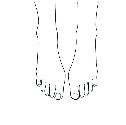 msdsalute's tweet photo. #Dolore al #tallone: #plantari universali efficaci come i personalizzati https://t.co/rkSf4V52m5 https://t.co/zoFsOUK2pS