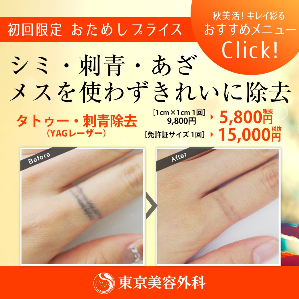 公式 東京美容外科 A Twitter タトゥーだけじゃない 消せるんです 肌の深い層まで届くレーザーで 刺青 タトゥー アートメイク等を除去します 黒い色素に反応するので 実はシミ ソバカス あざ 妊娠線 肉われにも効果を発揮します 気になる方はこちら