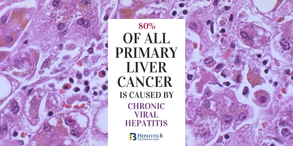 HepBFoundation's tweet photo. What's the #HepB Connection? October is #Liver #Cancer Awareness Month! #LCAM2017 #HBV #livercancer https://t.co/QKRZ67vRiC https://t.co/VcwdJlMv3o