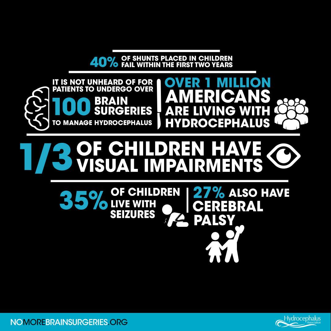 noel_cao's tweet photo. Please support my participation in the HA WALK to End Hydrocephalus!
https://t.co/OfkeNqg04g https://t.co/Pk1qhYfX6K