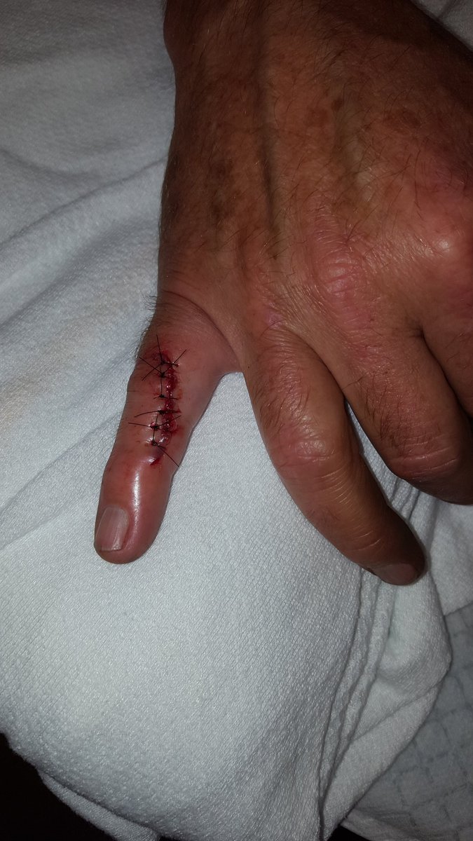 Frank Speer tweet media