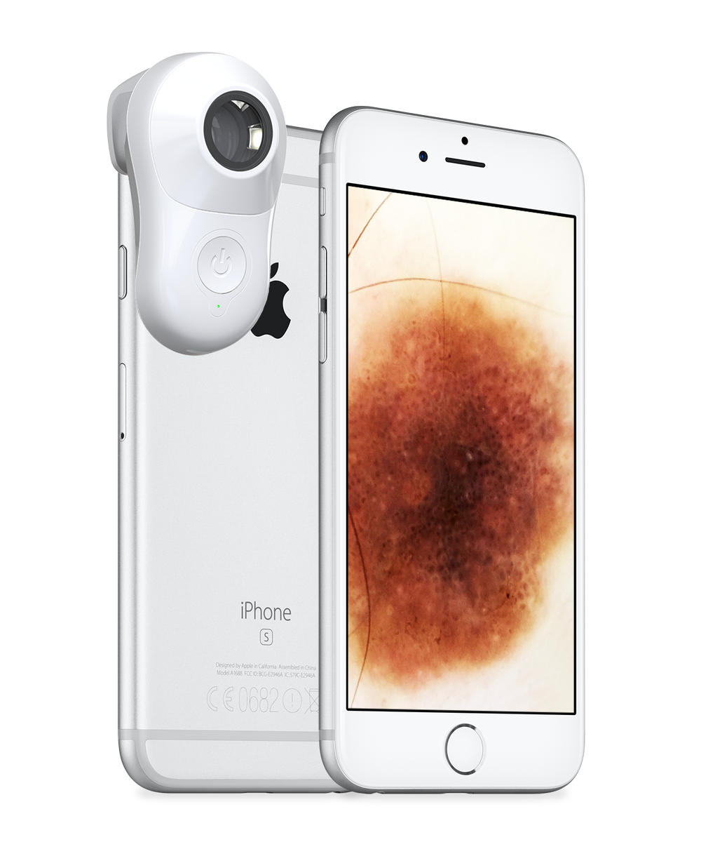 MetaOptima's tweet photo. Excited to be giving away 6 #MoleScopeII at the #Dermatology Update Conference in Vancouver today and tomorrow! #DermEngine #SkinCancer https://t.co/1cPJy5f9B7
