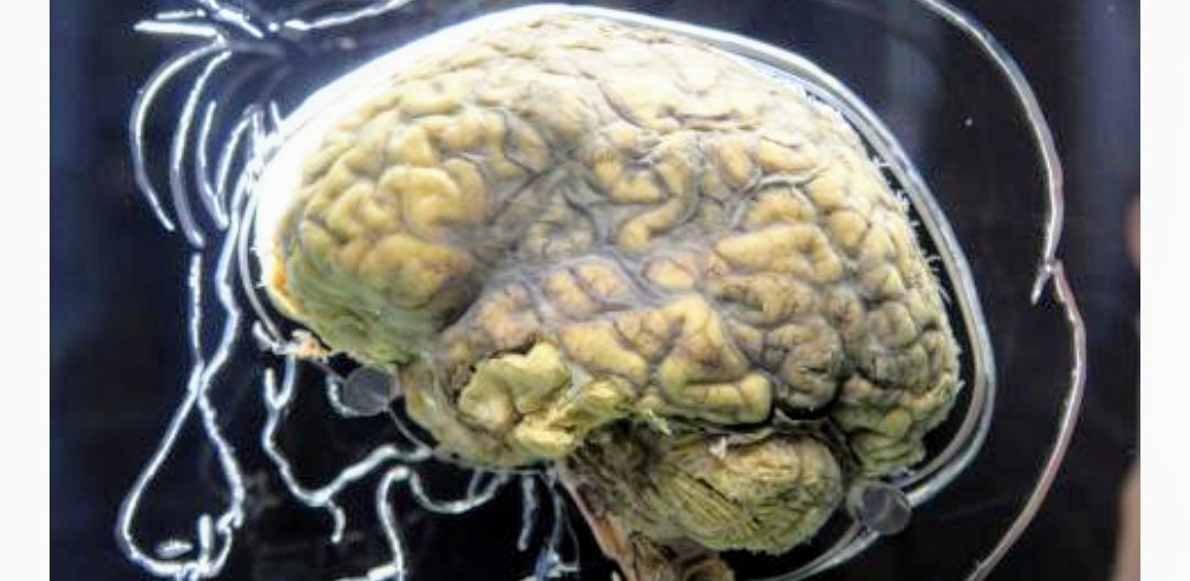 jcfrinak's tweet photo. .#DARPA Scientists Unveil #BrainDevice That Boosts #Learning 40 Percent - @Newsweek: https://t.co/JkdB4FQtBa  #tDCS #ElectricalStimulation https://t.co/NeSDckwaut