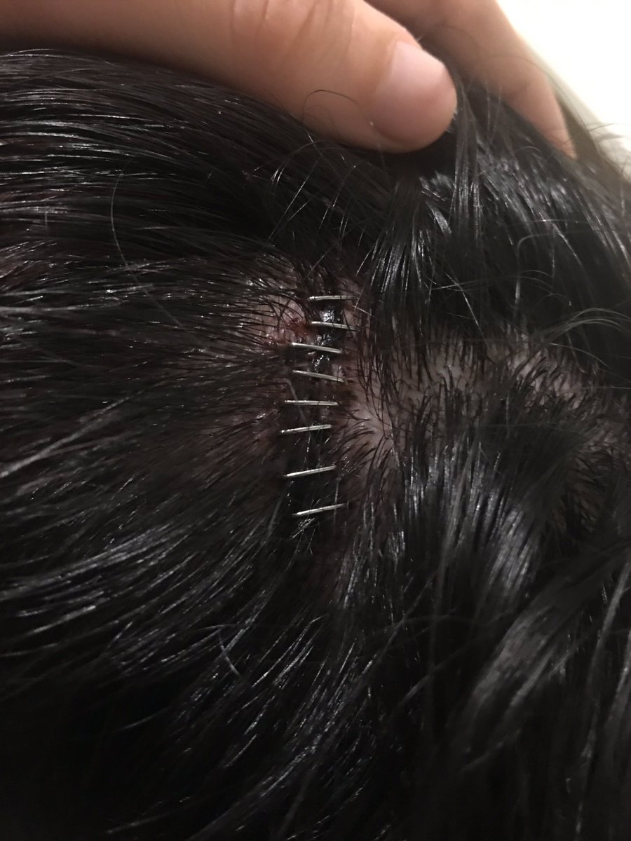 rt en 5 segundos o te ocurrira a ti !! 100%