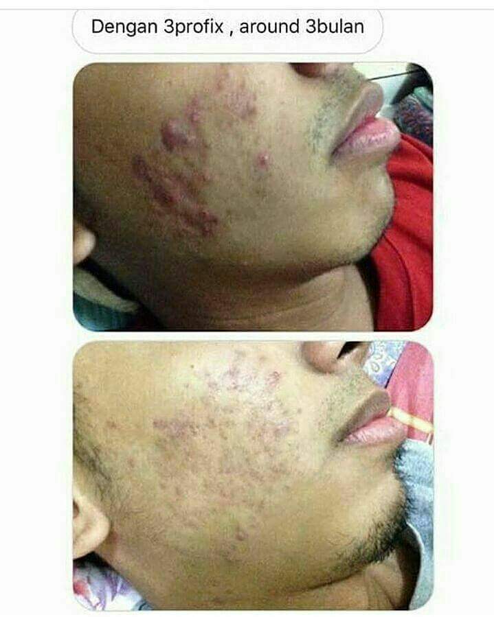 profixofficial's tweet photo. Lelaki pun boleh pakai gaiss.. takde masalah 😉
.
.
macam sis cakap. sis nak bantu guide sampai menjadi sesiapa ada masalah dibawah ini 👇 https://t.co/2cjBfsyHMo
