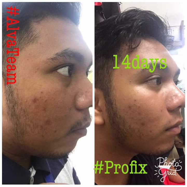 profixofficial's tweet photo. Lelaki pun boleh pakai gaiss.. takde masalah 😉
.
.
macam sis cakap. sis nak bantu guide sampai menjadi sesiapa ada masalah dibawah ini 👇 https://t.co/2cjBfsyHMo