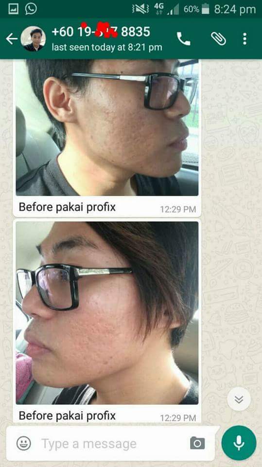 profixofficial's tweet photo. Lelaki pun boleh pakai gaiss.. takde masalah 😉
.
.
macam sis cakap. sis nak bantu guide sampai menjadi sesiapa ada masalah dibawah ini 👇 https://t.co/2cjBfsyHMo