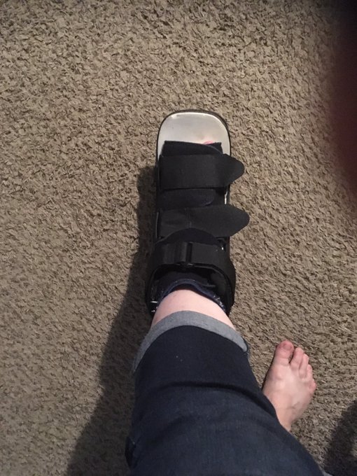 Current unsexy situation... anything to get me back to Ironman 70.3 training... lol https://t.co/KkL<a href="/tag/bbwcon"class="tags"><span>#bbwcon</span></a>