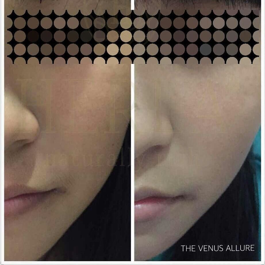 thevenusallure's tweet photo. 想要一眼看透的白皙皮肤？
改善皮肤光泽透亮只需10天 https://t.co/45SI52yNzi