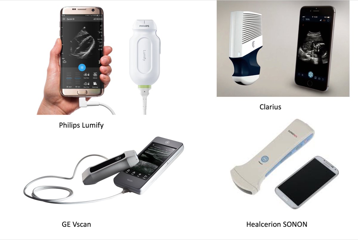 at home sonogram with a smartphone at home sonogram with a smartphone