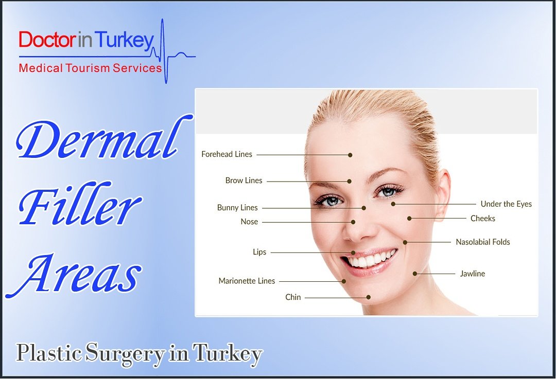 medigance's tweet photo. Dermal Fillers 👼
Plastic Surgery in Turkey💆💆

Our Winter-2017 prices are still available ! 

#dermalfillers #doctorinturkey #beauty https://t.co/0IiyWgjsgB