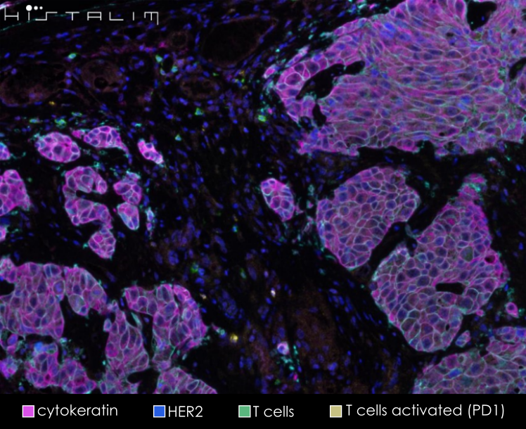 HISTALIM tweet media
