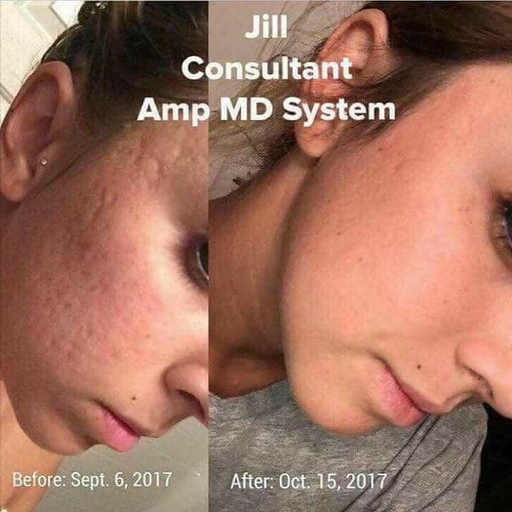 kalanicut's tweet photo. Take a small step or a big leap towards dewy, glowing skin today. Rodan + Fields bulk order happening now. Discount + free shipping. DM me. https://t.co/Seh8xJ9gGA