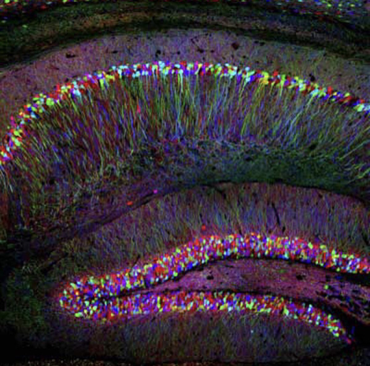 A neuron detection technique called a "Brainbow" technique uses  a brainbow of colors,where researchers can map neural circuits of brains.