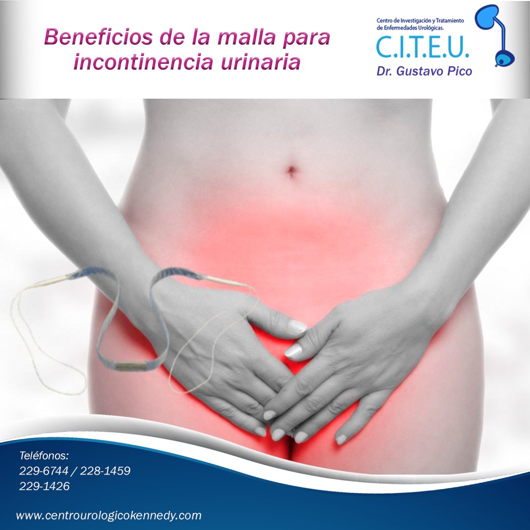 citeu_ec's tweet photo. Beneficios de la malla para incontinencia urinaria. https://t.co/2eYgXmZSDu https://t.co/ipYM5U8kuL